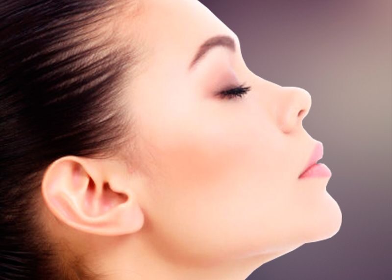 Jaw angling implant