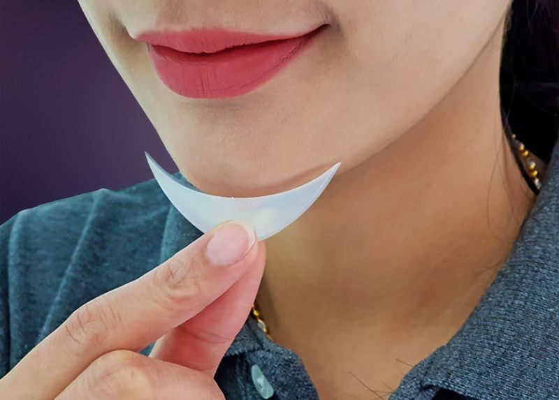 Medpore chin implant