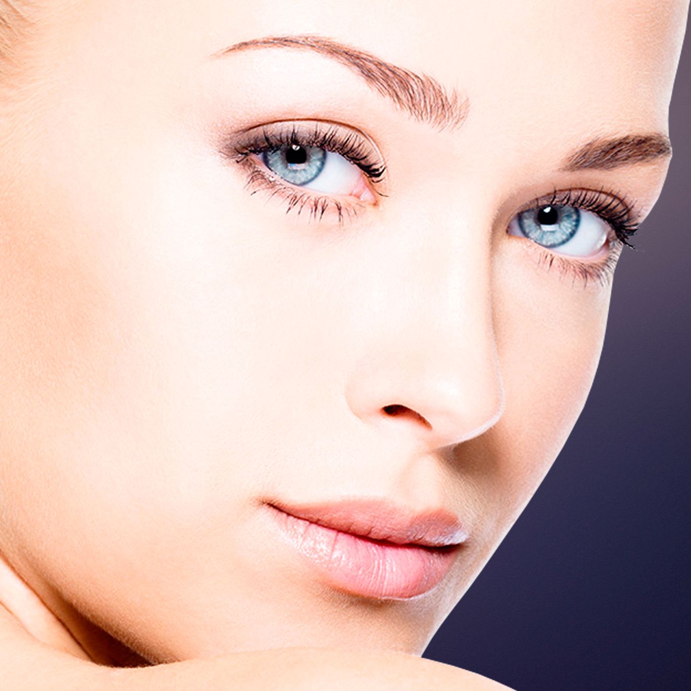 Female revision rhinoplasty in Toronto