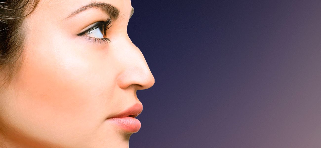 Before rhinoplasty surgery