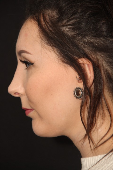 Refined nose shape after